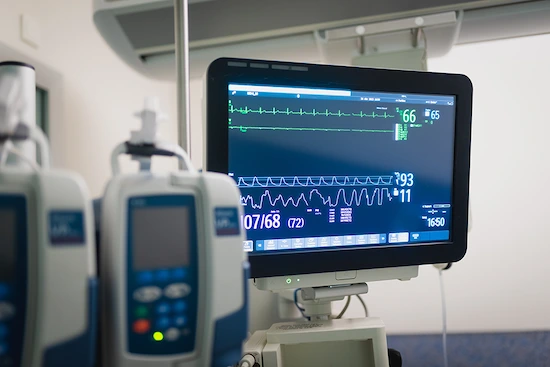 Monitor de signos vitales mostrando electrocardiograma y parámetros fisiológicos en unidad de cuidados intensivos
